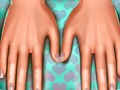 Jogo Médico da Pele: Mãos  online